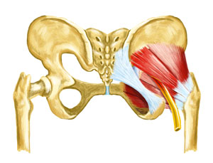 Piriformis Syndrome Treatment